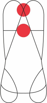 CAMP. Vertical